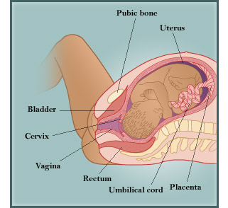 Birth diagram 1