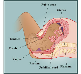 Birth diagram 2