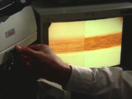 image of hair on television monitor