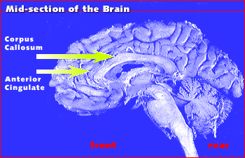 A cross-section of the human brain, with the anterior cingulate indicated