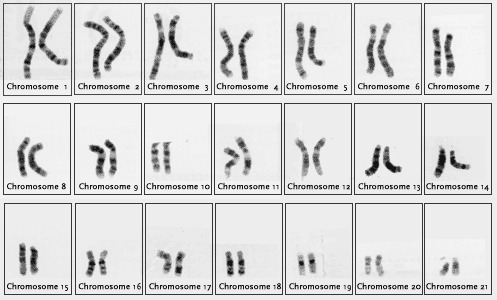Diagram of 21 human chromosomes