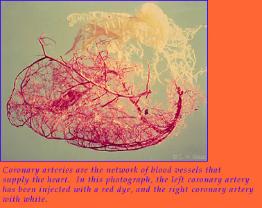 Coronary arteries are the network of blood vessels that supply the heart.  In this photograph, the left coronary artery has been injected with a red dye, and the right coronary artery with white.