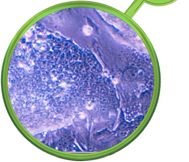 Stem Cells Breakthrough
