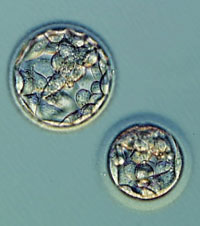 Blastocysts