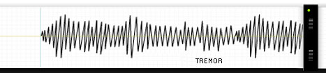 Tremor seismograph image